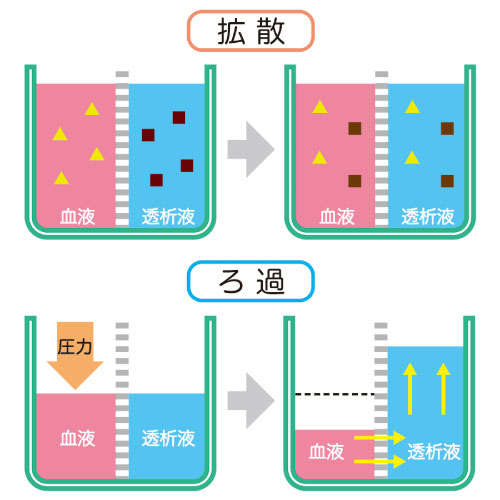 血液ろ過透析のメカニズム